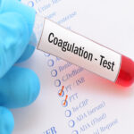 COAGULATION TESTS