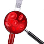 HEMOGLOBIN VARIANT ANALYSIS OR HB ELECTROPHORESIS