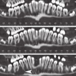 CT DENTAL SCAN