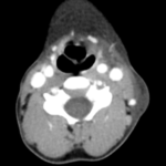 CT NECK PLAIN