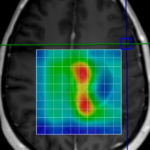 MRI CONTRAST WITH SPECTROSCOPY