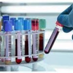 LEUKEMIA TRANSLOCATION  PANEL B (Inv(16(p13;q22,  t(15;17(q22;q22, t(8;21(q22;q22)