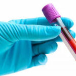 HISTOPATH PANEL                                                               IgG + IgA + IgM  + C-3 + C1q + FIBRINOGEN ON TISSUE