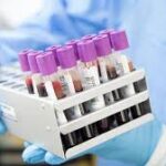 Kidney Panel                                                            Albumin, Alkaline Phosphatase (ALP), Chloride, Cholesterol - Total, Creatinine, Potassium, Protein Total, Sodium (Na), Urea, Uric Acid, Albumin / Globulin Ratio, Complete Urine Analysis (CUE)