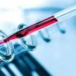 14 Q32 / IGH GENE  REARRANGEMENT