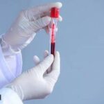 ACUTE PROMYELOCYTIC  LEUKEMIA (APL )