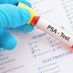 PROSTATE PANEL                                                                 PSA FREE & TOTAL