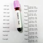 TORCH 4 Profile (IgG)Toxo IgG; Rubella IgG; CMV IgG; HSV-I&II IgG