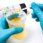 UTI SCREENING PANEL                                                           CBC,ESR,GLUCOSE FASTING,  URINALYSIS,URINE  CULTURE/SENSITIVITY