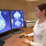 BREAST CANCER MONITOR I                                               CA 15-3, CEA,VITAMIN D