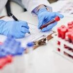 LYMPHOCYTE  ENUMERATION STUDY -T  CELLS  PANEL                                              %CD3,%CD4,%CD8,ABS CD3,ABS CD4,ABS CD8