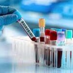 RUBELLA IGM / IGG +VE  REFLEX RUBELLA RNA PCR