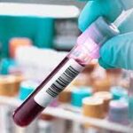 ABSOLUTE LYMPHOCYTE COUNT