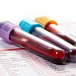 THYROID SCREENINGATPO,ATG,Calcitonin,Thyroglobulin,T3,T4,FT3,FT4,       TSH