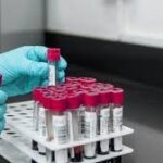 LYMPHOCYTE  ENUMERATION T & B CELLS PANEL                                %CD3,%CD19,ABS CD3,ABS CD19