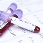 LYMPHOCYTE  ENUMERATION, T- HELPER  CELLS PANEL                                                                     %CD3,%CD4,ABS CD3,ABS CD4