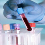 ACID FAST BACILLI STAIN & (5 SAMPLES)